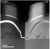 High-angle annular dark field (HAADF), annular dark field (ADF) plus bright and dark field (BF/DF) detectors