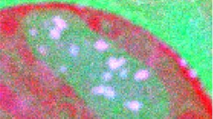 EELS elemental mapping of cryogenically frozen mitochondria in human retinal ganglion cells
