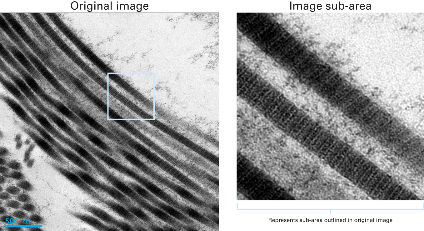 Clearly resolved collagen fibrils