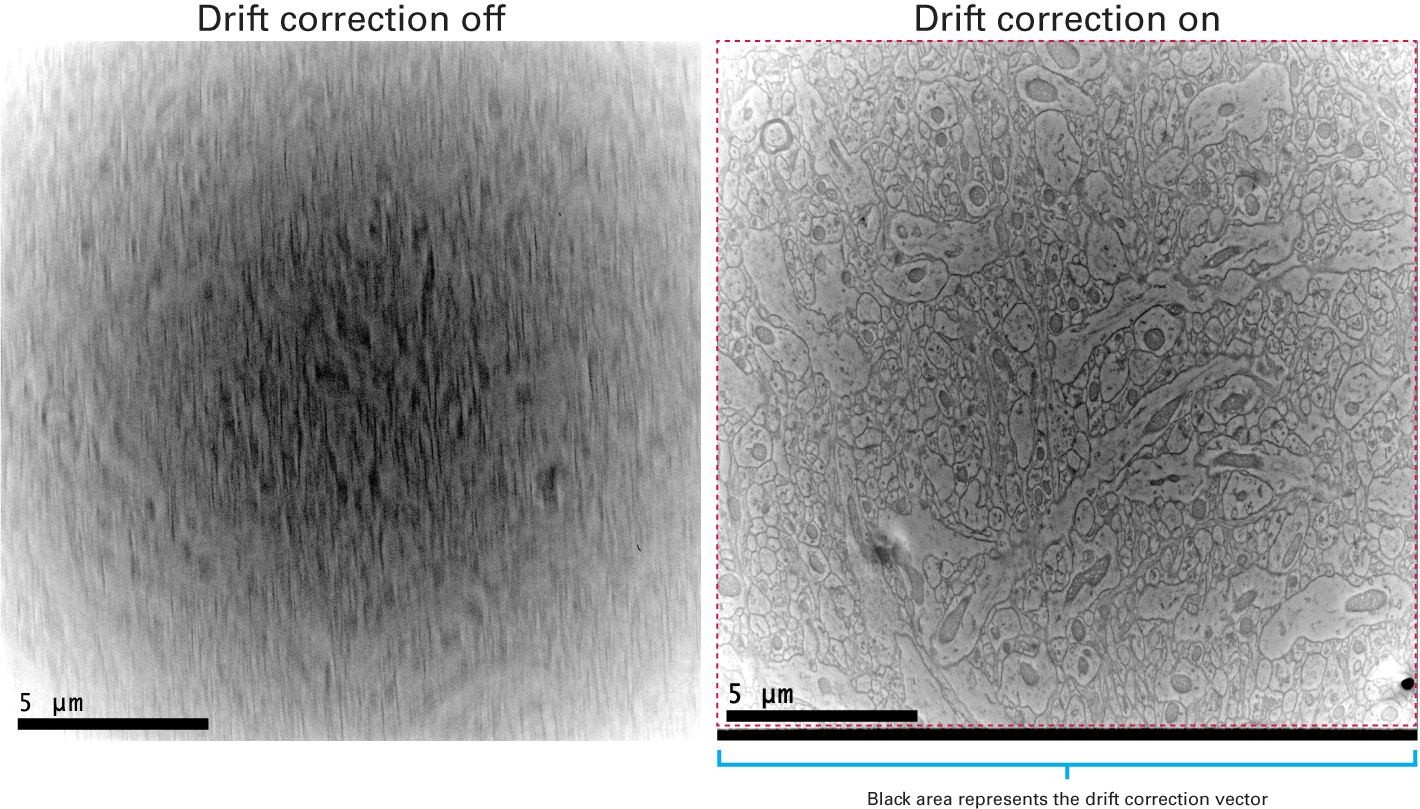 Drift correction compensates for brain sample motion