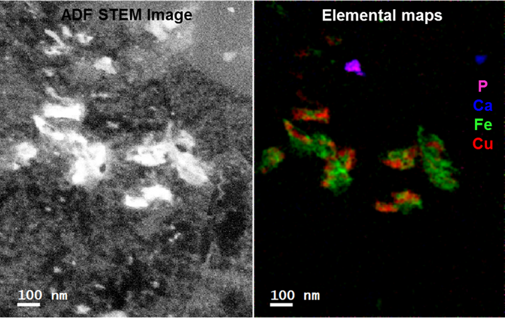 Fast EELS Analysis of Metals in a Blood Cell