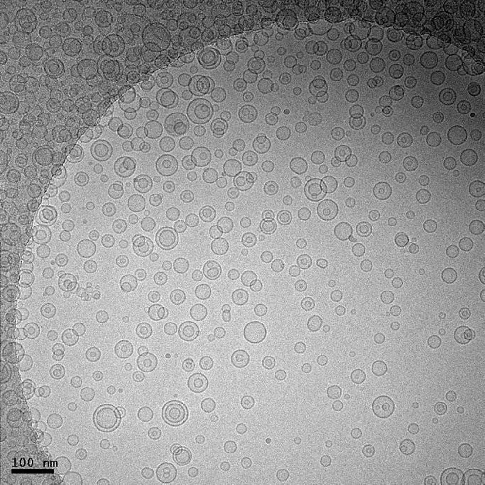 Frozen hydrated lipid vesicles