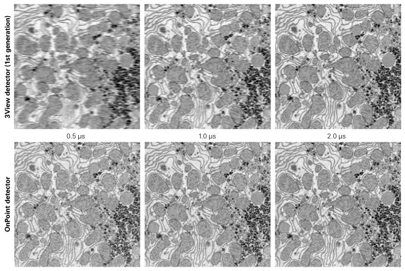 OnPoint increases 3View imaging speed four-fold