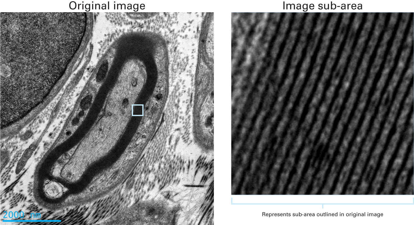 Clearly resolved myelin sheaths and collagen fibers