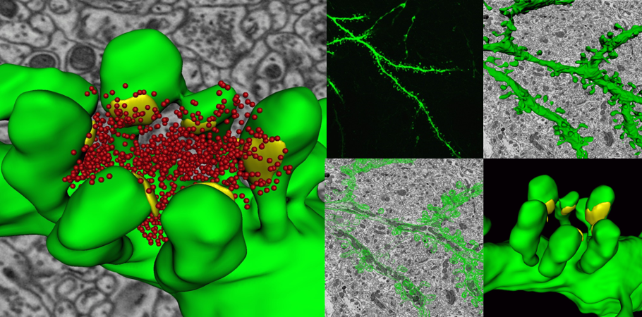 Scanning electron microscopy of human islet cilia