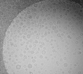 Frozen hydrated lipid vesicles