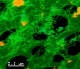 3D Tomo Carbon Nanotubes