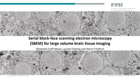 SBEM for large volume brain tissue imaging webinar