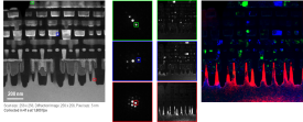 4D STEM and Virtual Aperture Imaging with ClearView