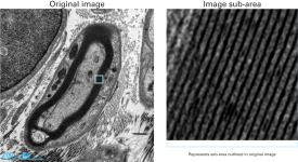 Clearly resolved myelin sheaths and collagen fibers