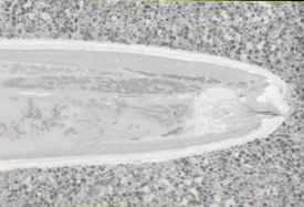 3View imaging of c. elegans