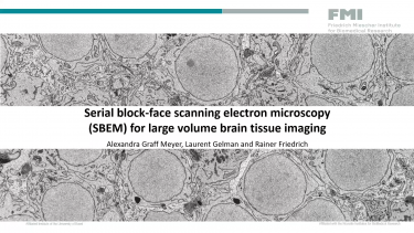 SBEM for large volume brain tissue imaging webinar