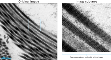 Clearly resolved collagen fibrils