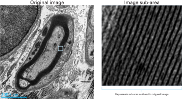 Clearly resolved myelin sheaths and collagen fibers