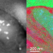 EELS elemental mapping of cryogenically frozen mitochondria in human retinal ganglion cells